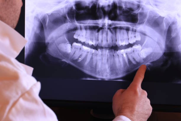 Best Dentist for Tooth Abscess  in Mcpherson, KS
