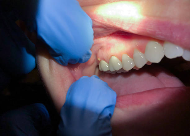 Best Affordable Emergency Dental Care  in Mcpherson, KS