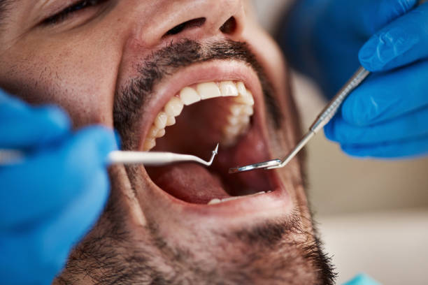 Best Cracked Tooth Emergency Dentist  in Mcpherson, KS