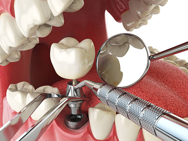 Emergency Dentist for Kids in KS